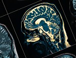 A brain scan
